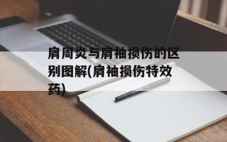 肩周炎与肩袖损伤的区别图解(肩袖损伤特效药)