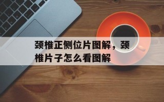 颈椎正侧位片图解，颈椎片子怎么看图解