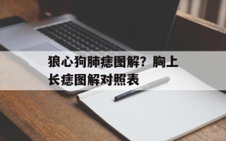 狼心狗肺痣图解？胸上长痣图解对照表
