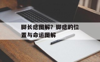 脚长痣图解？脚痣的位置与命运图解