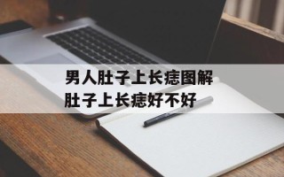 男人肚子上长痣图解 肚子上长痣好不好