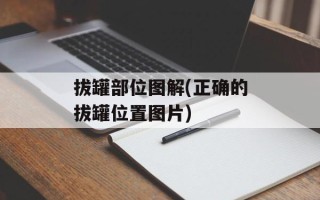 拔罐部位图解(正确的拔罐位置图片)