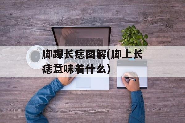 脚踝长痣图解(脚上长痣意味着什么)-第1张图片-