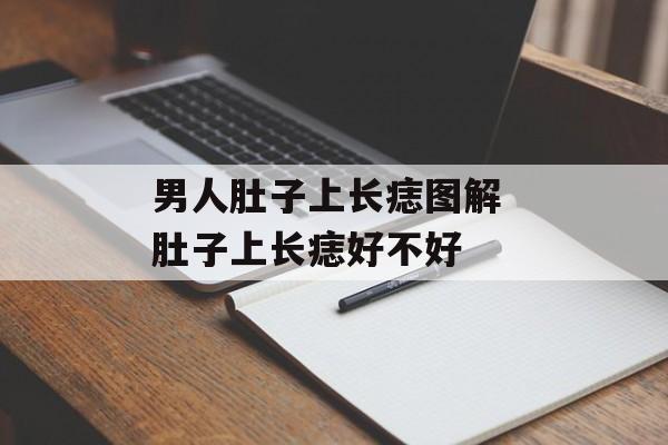 男人肚子上长痣图解 肚子上长痣好不好-第1张图片-